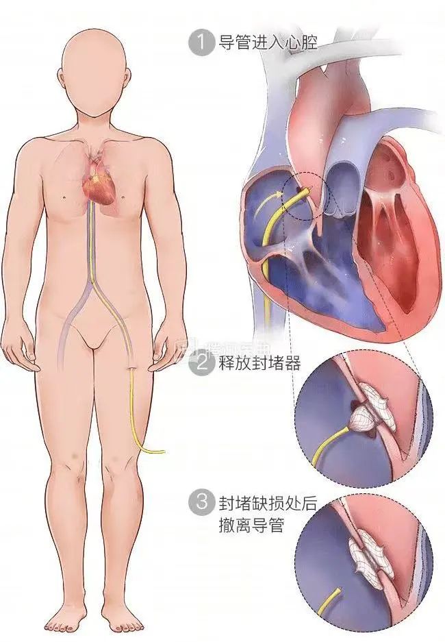 2d5c94151e1339de732844c96f49e56a.jpg