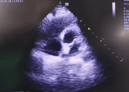 7.gif
